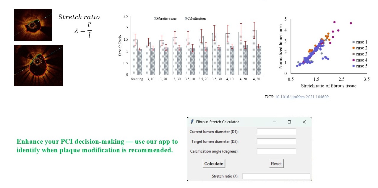 graphs illustrating research of fibrotic tissue stretch as an index for lumen gain and our app that helps to identify when plaque modification is recommended in PCI
